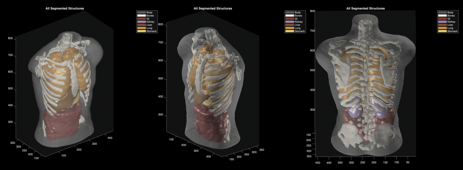 A behind-the-scenes look at Midjourney’s medical scanner leaves many questions unanswered