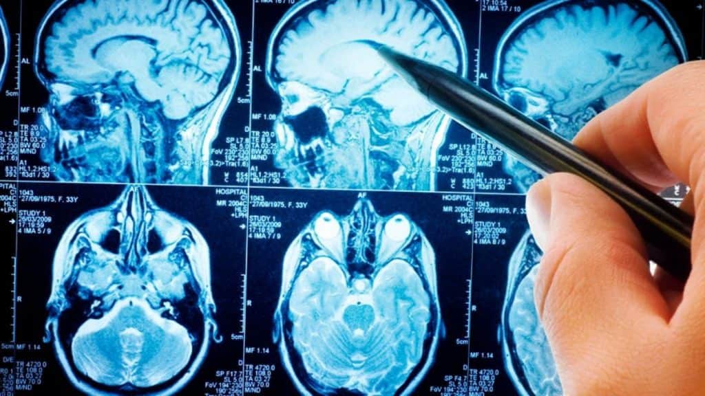 Ondas cerebrais no sono podem revelar risco de demência