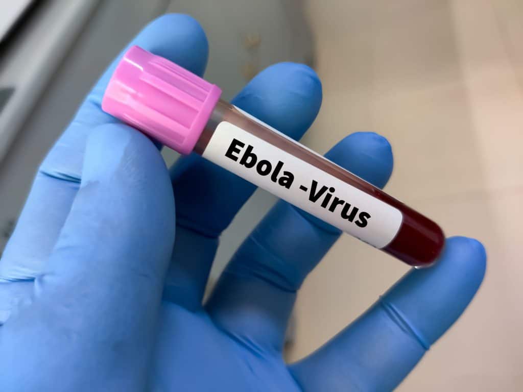 Ministro de Saúde do Congo nega que surto de Ebola esteja “fora de controle”