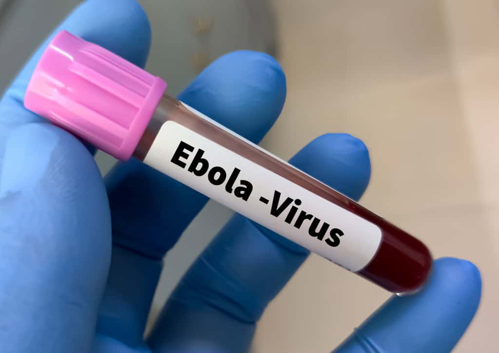 Surtos de doenças infecciosas tornam-se mais frequentes e prejudiciais